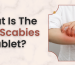 Scabies